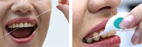 Igiena orală - Clinica stomatologică Professional Dentist din Iași