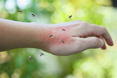 How Dangerous Are Mosquito Bites at Joseph Cole blog