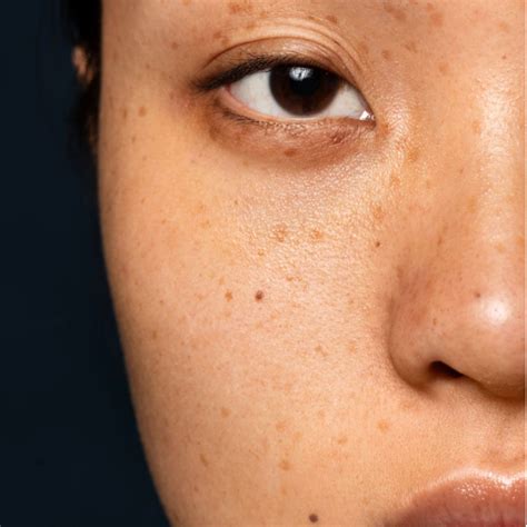 Unveiling Australia’s Top 3 Dark Spot Reducing Products by Guinot ...