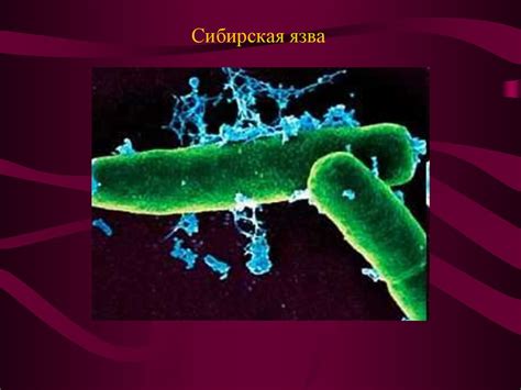 Сибирская язва - презентация онлайн