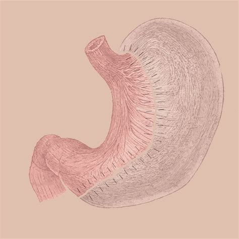 What Is Vertical Sleeve Gastrectomy?