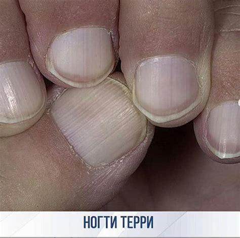 От анемии до рака: опасные болезни, которые можно определить по цвету ...
