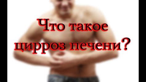 Цирроз печени - симптомы, лечение, стадии, признаки - YouTube