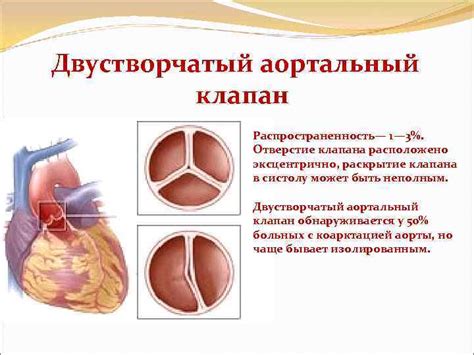 Пороки аортального клапана этиология патогенез Выполнила студентка 2