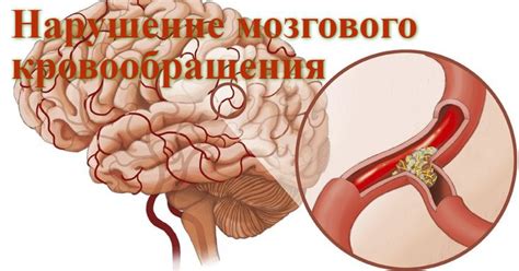 Лекарственные растения при нарушении мозгового кровообращения | Советы ...