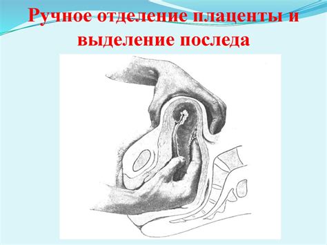 Кровотечения в последовом и раннем послеродовом периоде - презентация ...