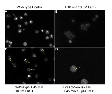 ring  actin structures  cc  cells  induced  prolonged