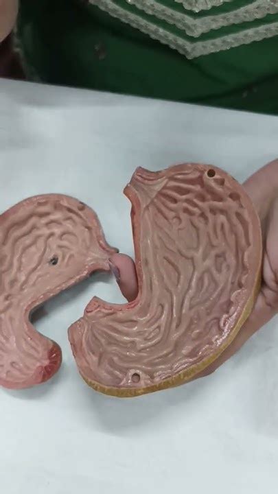 gross anatomy stomach ospe stomach grossanatomy abdomenpelvis