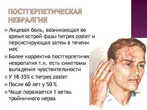 ЛИЦЕВЫЕ БОЛИ И КРАНИАЛЬНЫЕ НЕВРАЛГИИ Руина Екатерина Андреевна