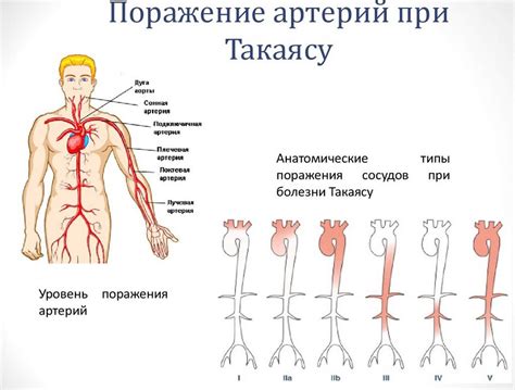 Подключичная артерия: анатомия, топография, сегменты, отделы, ход, диаметр