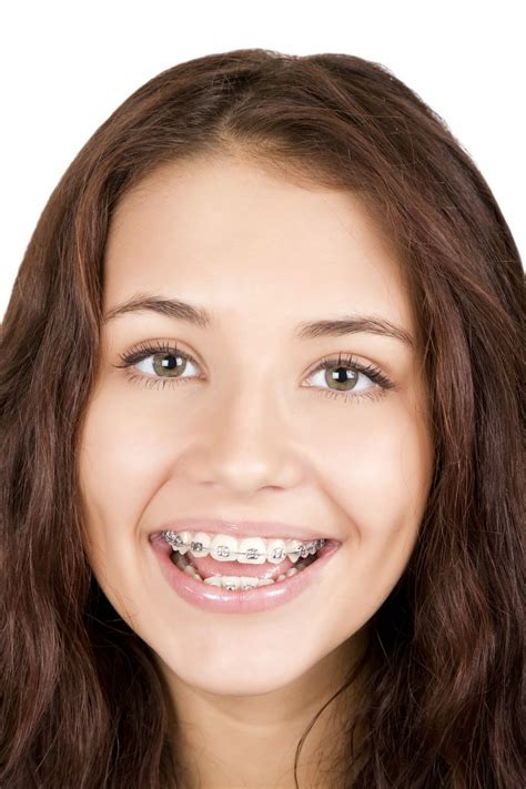 dentist bangalore
