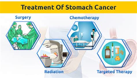 Gastric cancer (stomach cancer) - Ay Health Medical Services Company