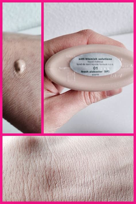 Nika's Beauty Experiences: Clinique anti-blemish solutions