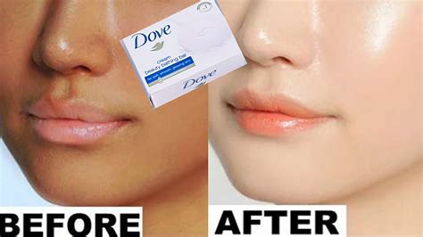 Dove soap for skin whitening cream | Instant skin whitening and ...
