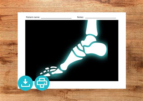 Printable X-rays for Kids. Pretend Play Kids X-ray Activity for Playing