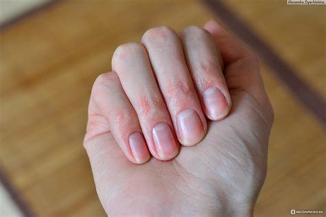 Гель для удаления кутикулы Sally Hansen Instant Cuticle Remover - «Это ...