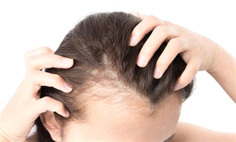 hair loss treatment tips ergonomics simplified