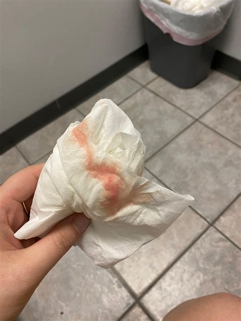 Why Is My Period Blood Watery? - PinkParcel