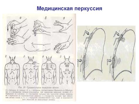 Осмотр грудной клетки. Патологические формы грудной клетки - online ...