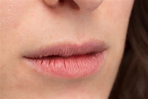 What Causes Constant Dry Mouth And Lips | Lipstutorial.org
