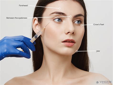 beginners guide  botox treatment  singapore vincerecliniccomsg