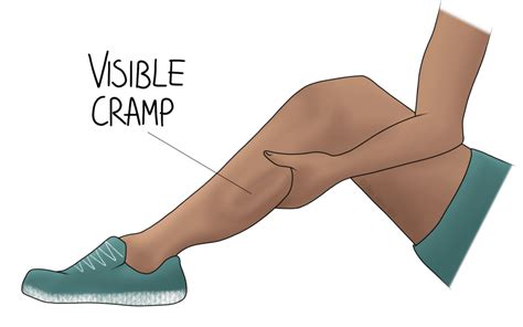 Find out how osteopathy can help treat cramp - The Carlton Clinic