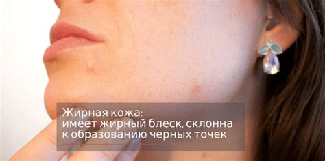 Жирная кожа - правильный уход в домашних условиях. | Кожа ...