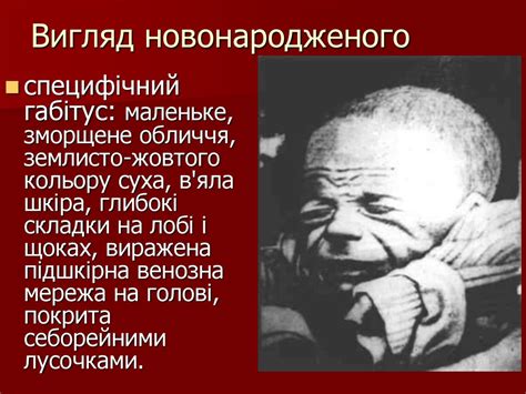 Сифіліс третинний. Вродженний сифіліс - презентация онлайн