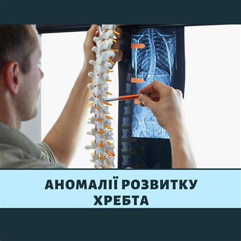 Аномалії розвитку... - Центр сучасної реабілітації Комфортмед