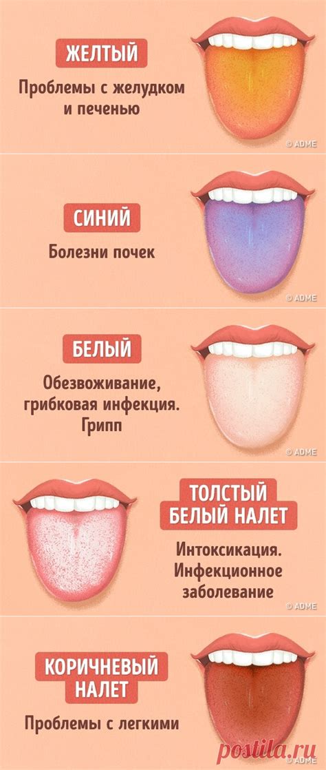 12 проблем, о которых может рассказать цвет языка | ПОЗНАЙ СЕБЯ | Постила