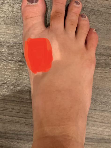 Pain In Arch Of Foot When Moving Big Toe at Annabelle Barclay-harvey blog