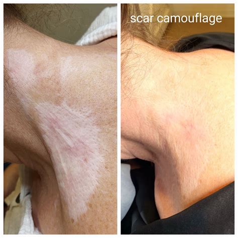 Scar Camouflage — Primped365