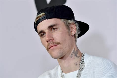 Did Justin Bieber's Accident Really Happen As Reported? The Evidence Speaks Image 8