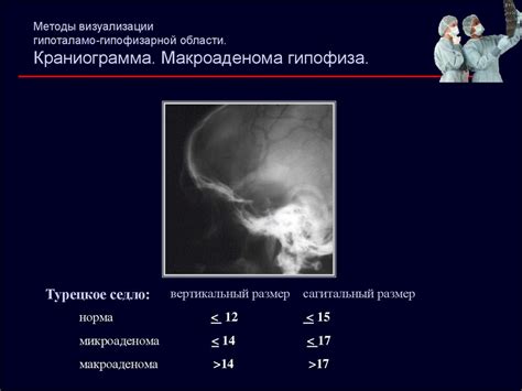 Заболевания гипоталамо-гипофизарной системы. Этиология, патогенез ...