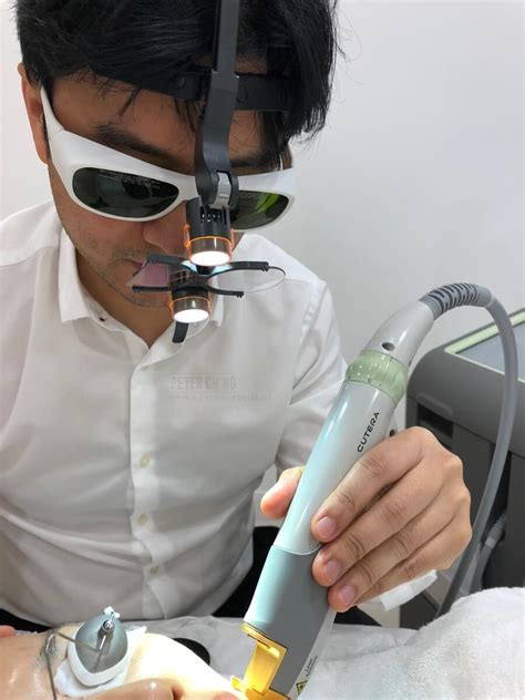 Permanent Hair Removal | Peter Chng Skin Specialist - KL, Malaysia