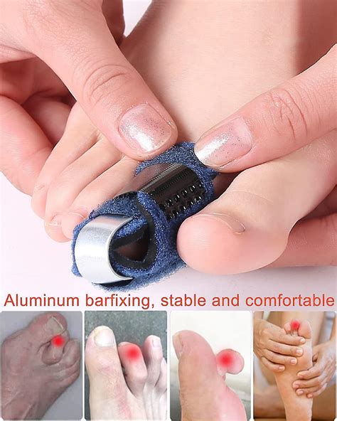 how to know if your toe is broken 6