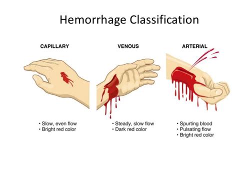 PATHOLOGY: HEMORRHAGE