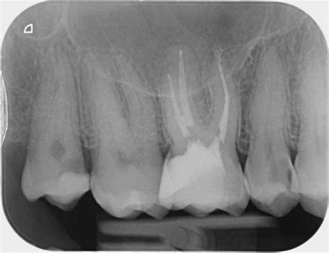 cabinet prodigue endodontie exclusive stomatologie gembloux