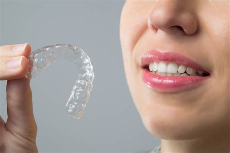 invisible braces ottawa dentist