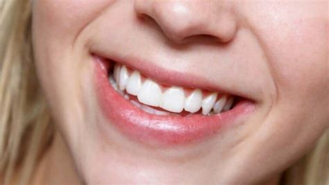 Best Products to Whiten Teeth Naturally - Step To Health