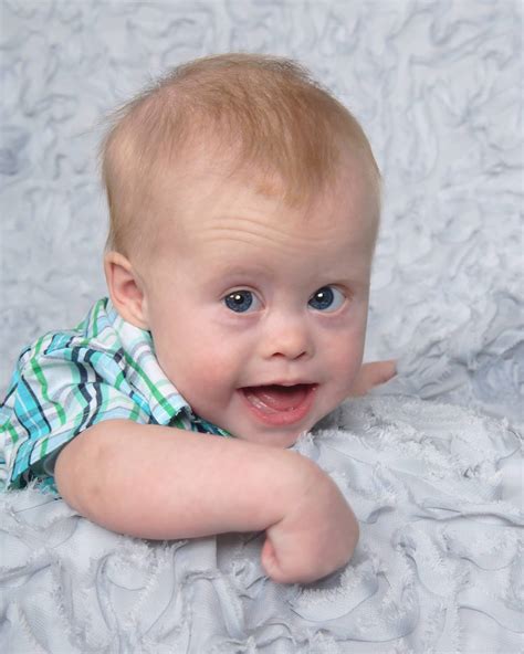 Down Syndrome Mom Of Baby With Down Syndrome Confronts Comments In