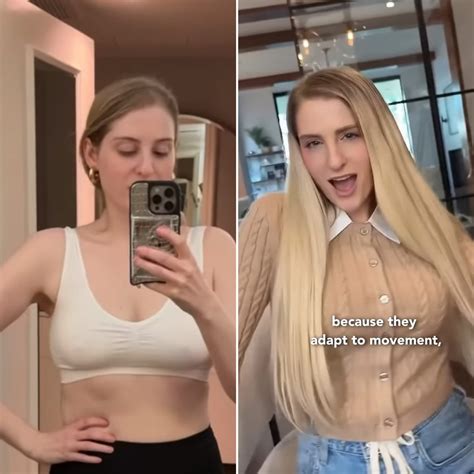 Meghan Trainor Shares Before and After Photos From Breast Augmentation