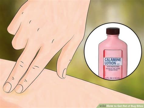 how to get rid of scars from bug bites