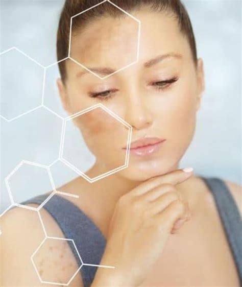 General Information Dermatology