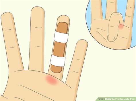 how to fix my broken knuckle