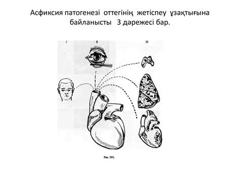 Асфиксия - презентация онлайн