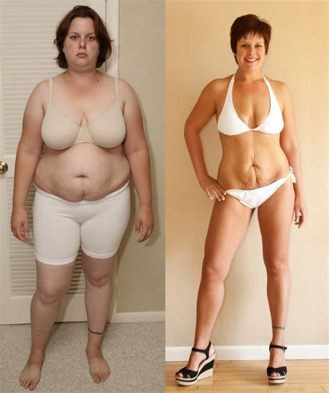 Weight Loss Before And After Legs at Lauren Murphy blog