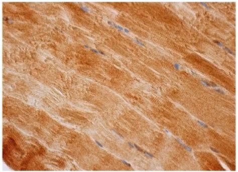 Anti-CRMP-5 Antibody (H-9) | SCBT - Santa Cruz Biotechnology