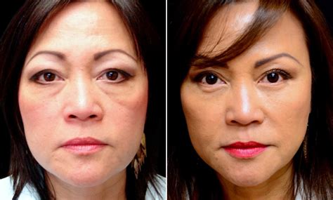 Festoons Face at Josephine Randle blog