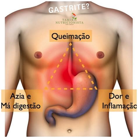 Como E A Dor Da Gastrite